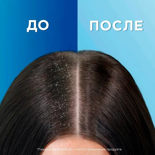 Шампунь против перхоти "Head & Shoulders" 2в1 Ментол 200 мл