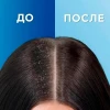 Шампунь против перхоти "Head & Shoulders" 2в1 Основной уход 400 мл